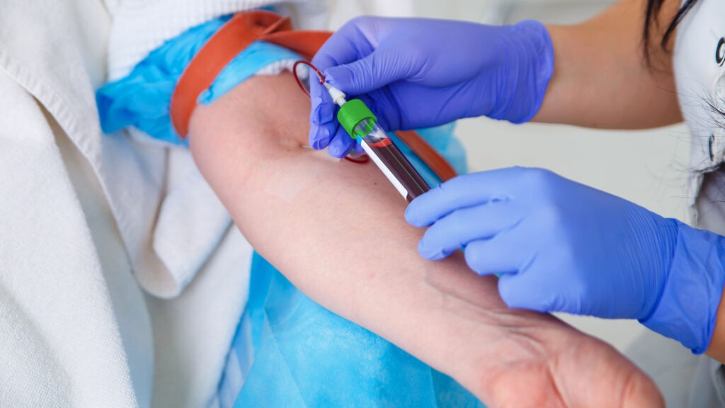 Phlebotomist Jobs